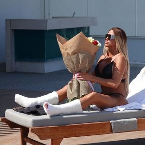 Katie Price Sits Poolside with Both Legs in Casts After Her Freak Accident in Turkey (13 Photos) – Leaked Nudes